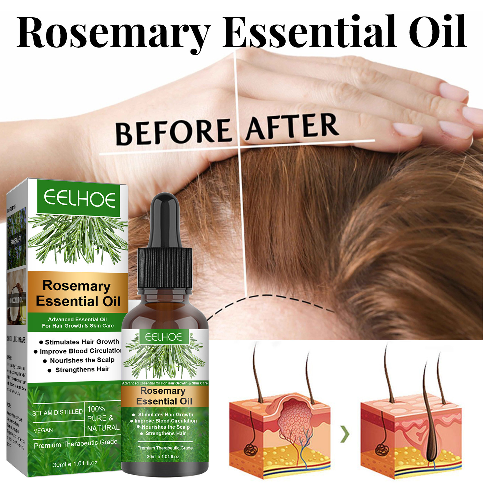 Best of Hair Growth Essence Products Rosemary Essential Oil Fast Regrowth Hair Prevent Hair Loss Multi-effect Hair Care For Men / women Reviews & Tips