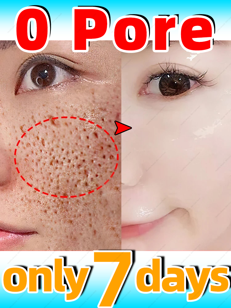 Best of Pore Shrinking Serum Pores Refining Remove Blackhead Oil Control Firming Reviews & Tips