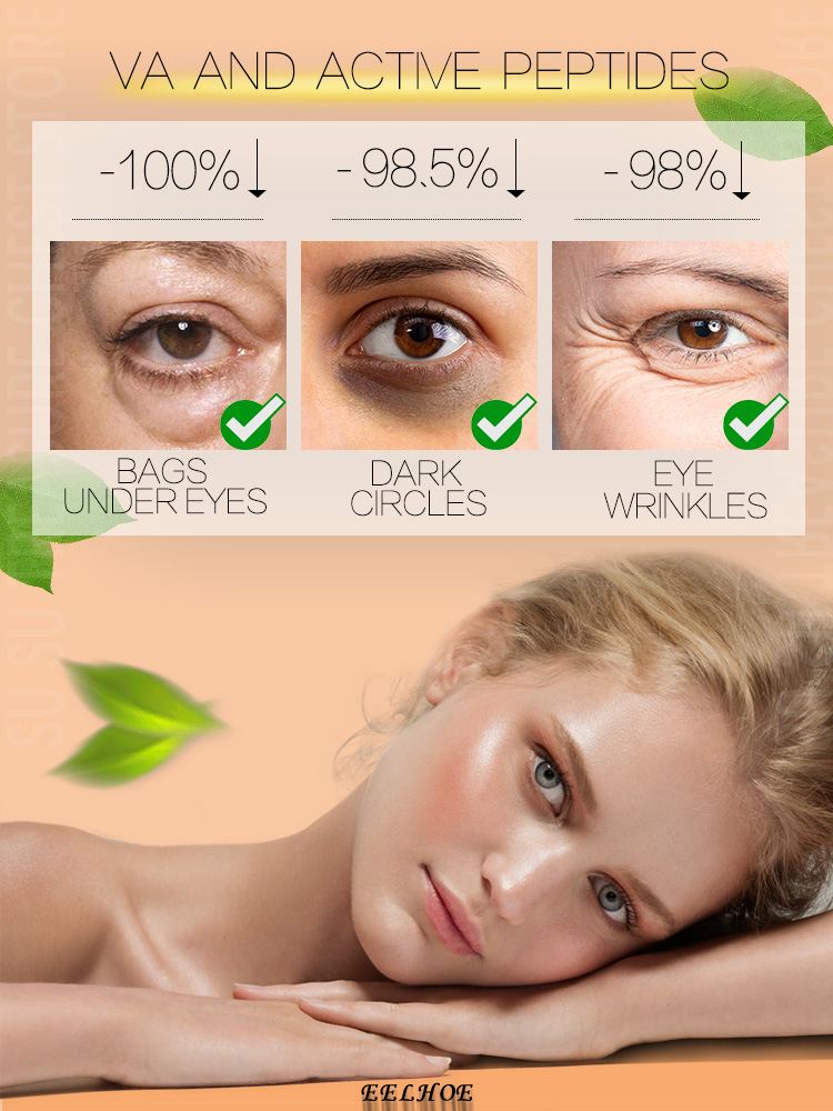 Best of Eye Cream Under Eye Bag Puffy Fat Removal Reviews & Tips