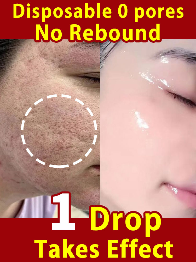 Best of Pore Shrinking Serum Narrowing Facial Open Pores Reviews & Tips