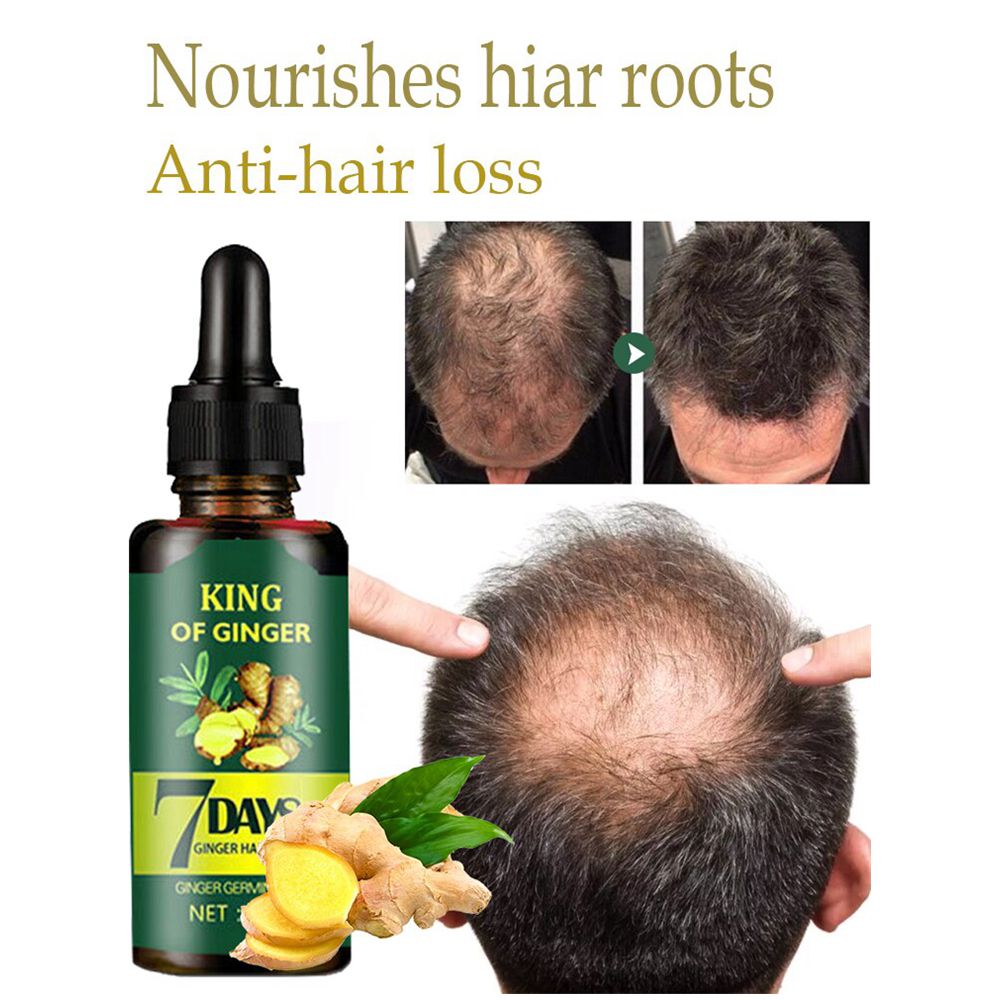 Best of Ginger Hair Growth Product Fast Growing Hair Essential Oil Anti Hair Loss Scalp Treatment Repair Damaged Hair Roots Men / Women Reviews & Tips