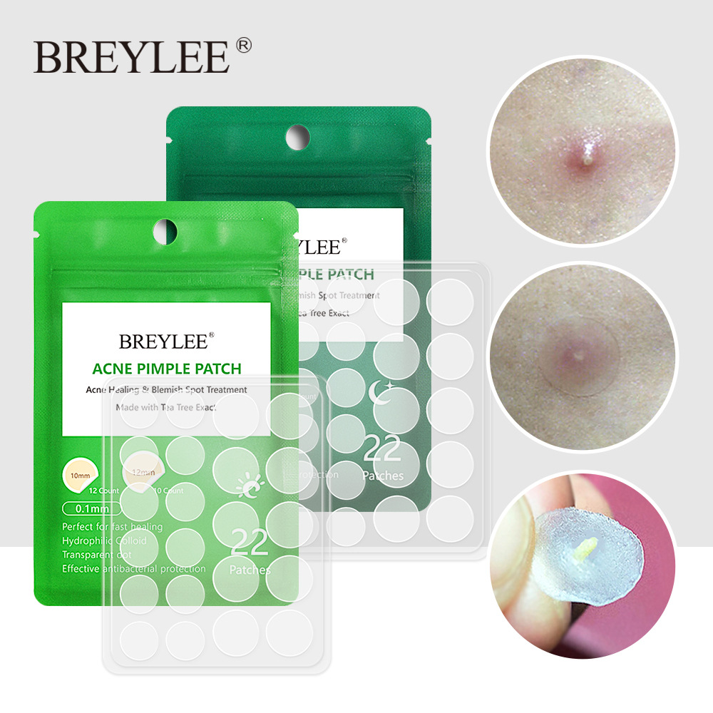 Best of BREYLEE Acne Pimple Patch Stickers Acne Treatment Pimple Remover Tool Blemish Spot Facial Mask Skin Care Waterproof 22 Patches Reviews & Tips