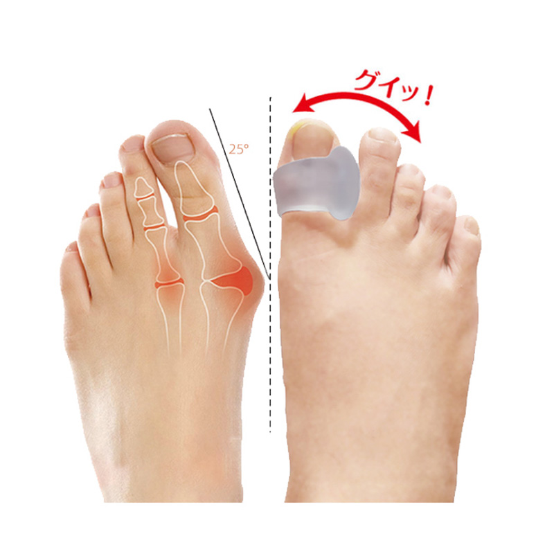 Best of 2Pcs=1Pair Silicone Gel Big Toe Separator Bunion Adjuster Foot Fingers Protector Bone Hallux Valgus Corrector Foot Care Pedicure Reviews & Tips