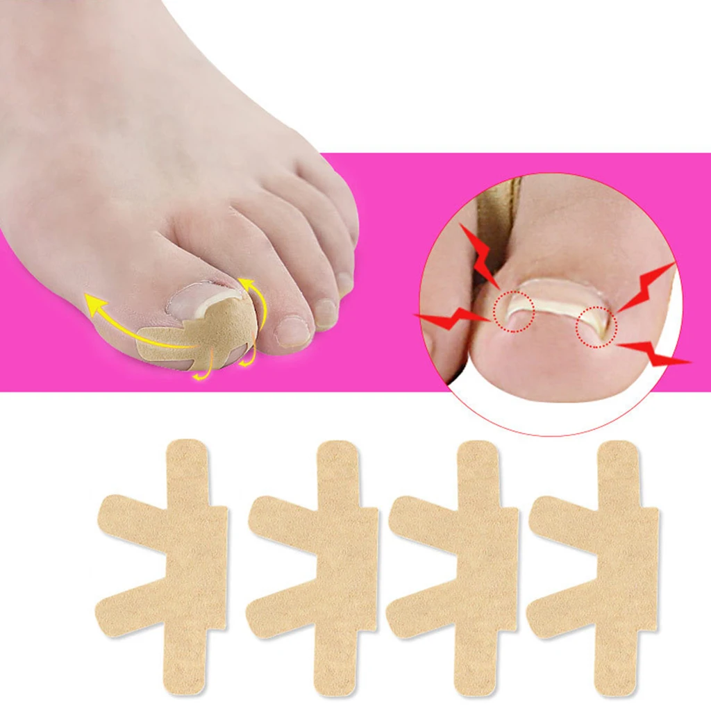 Pack 4 Ingrown Toenail Corrector Straightener Toenail Patch Brace Foot Care