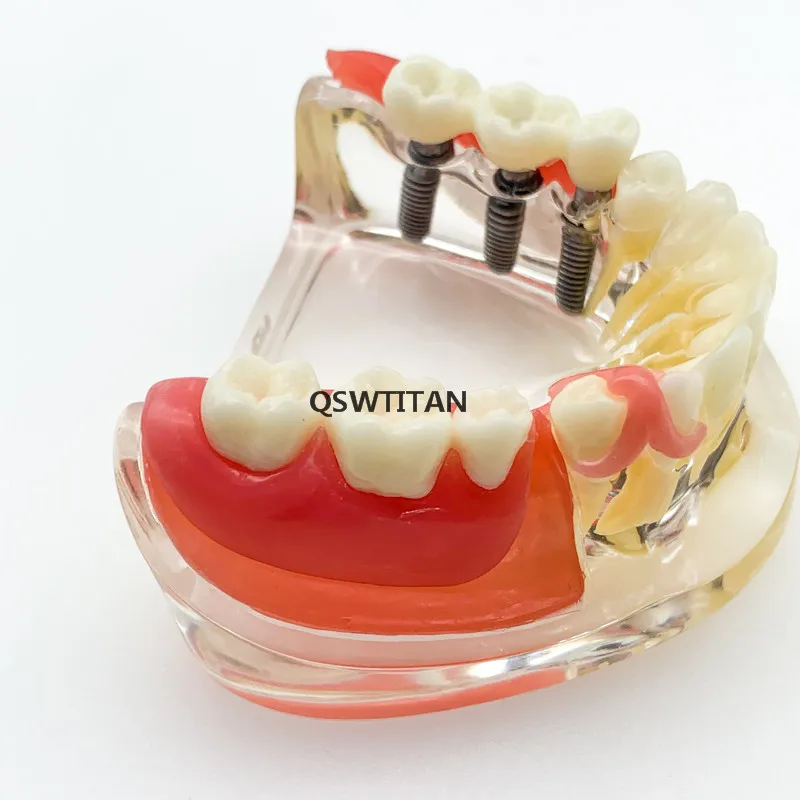 Modelo de Ensino Dental