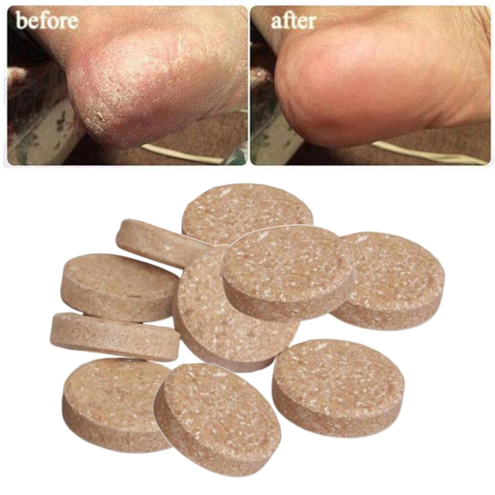8Pcs Effervescent Balls Anti- Foot SPA for Foot Pain Foot Bath Men
