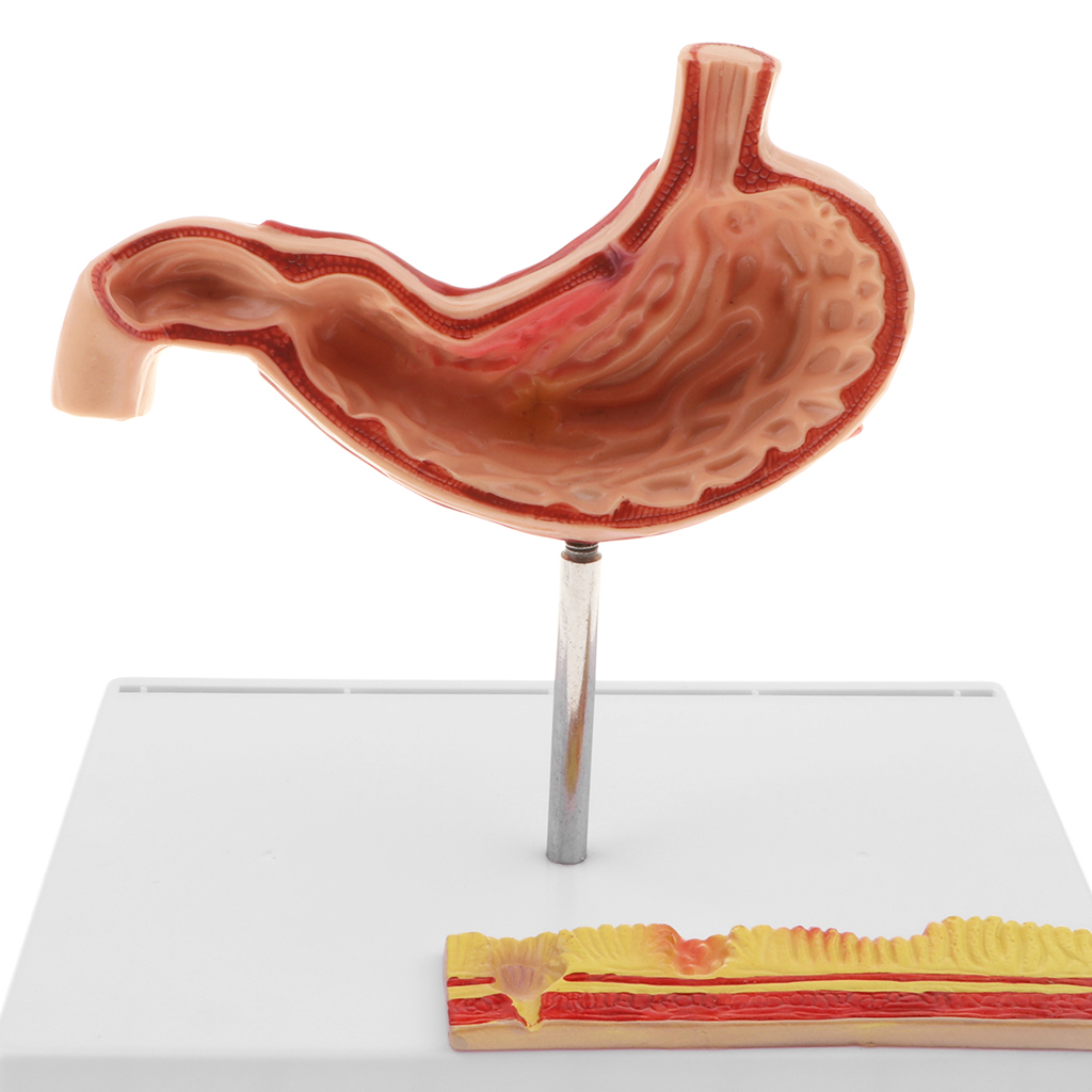 1: 1 Human Stomach Model with Detailed Illustrations, Anatomy