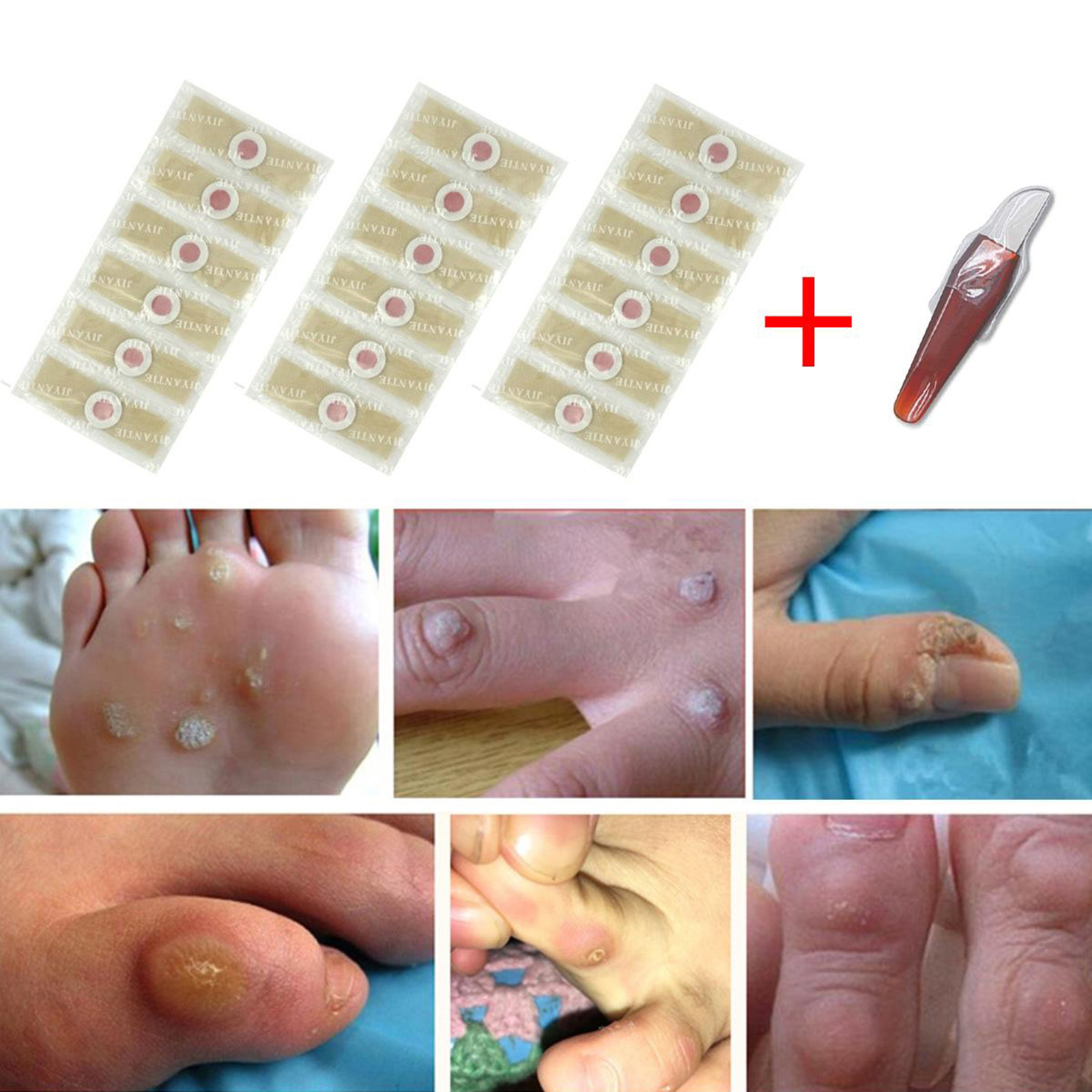 Foot Corn Remover Corn Remover Cushions Adhesive Toe Corn Cal