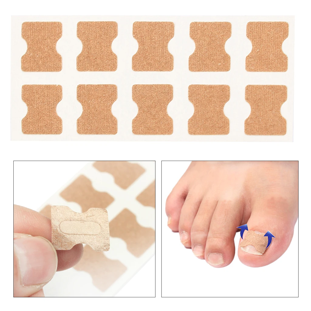 Toe Nail Repair Corrector Stickers  Treatment Correction Tool