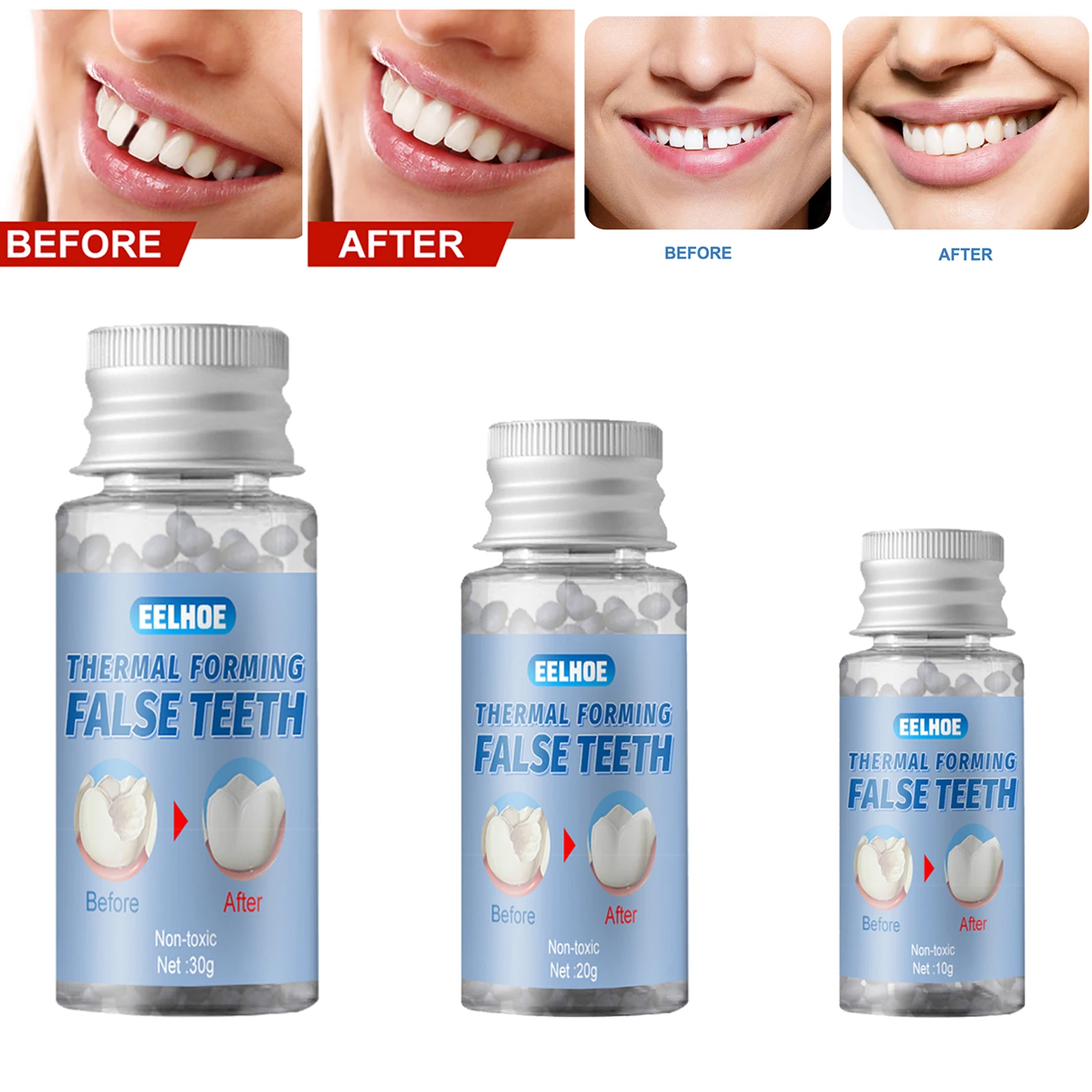 1Bottle Thermal Fitting Beads Teeth Veneers Moldable Temporary Tooth Repair Kit for Fix the Missing Tooth Teaching