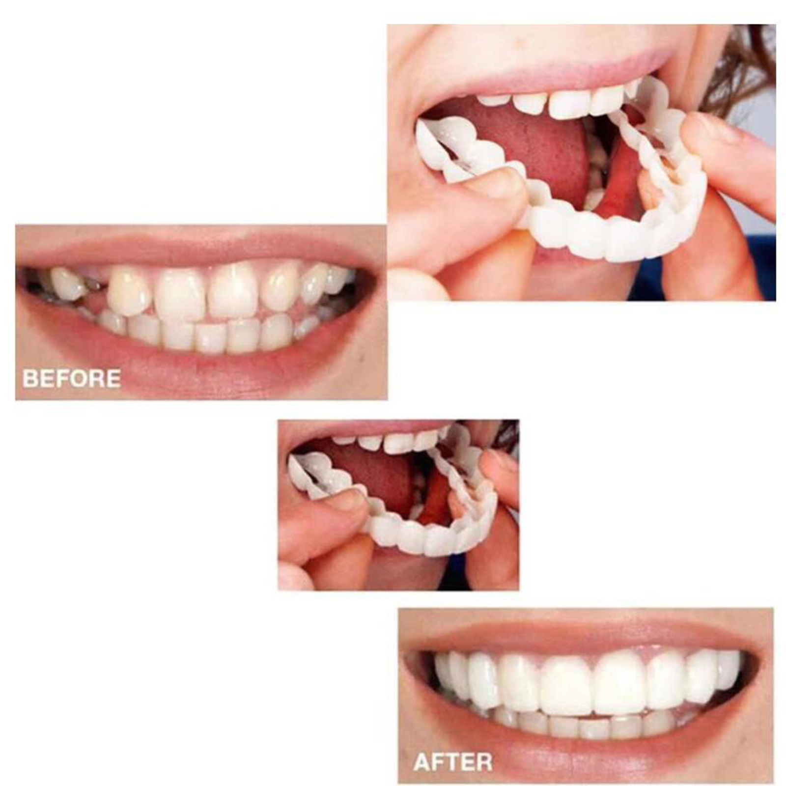 Resin Perfect Smiling Snap Lower Upper False Teeth Veneers Fake Tooth Cover