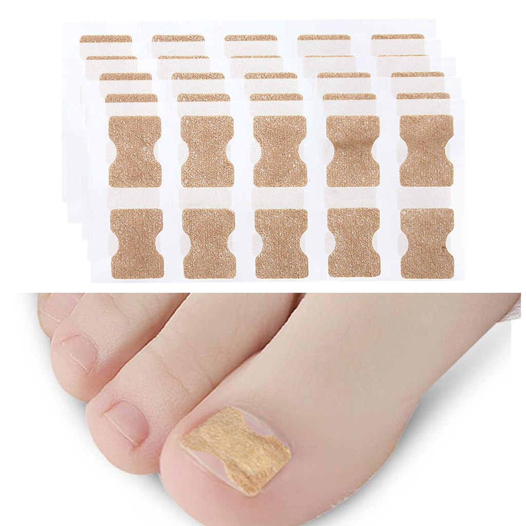 Pack 50 Ingrown Toenail Corrector  Treatment Tape Foot Nail Care