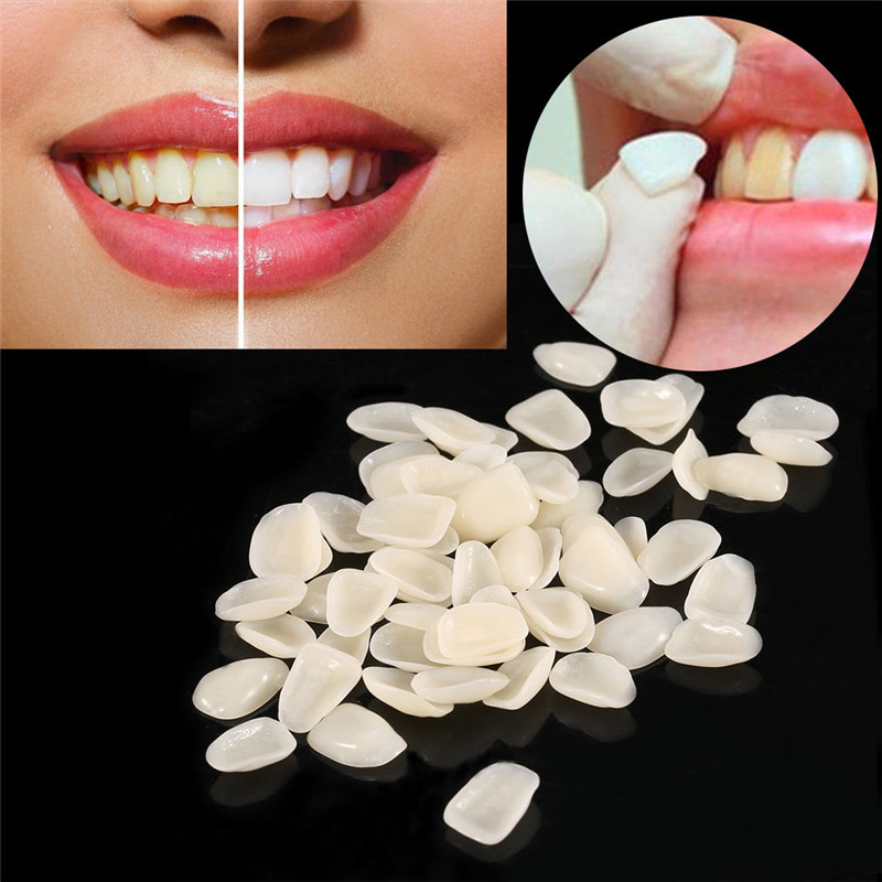 Best of 50pcs Dental Temporary Crown Ultra Thin Resin Whitening Teeth Anterior Shade Dentist Tooth Veneers Reviews & Tips