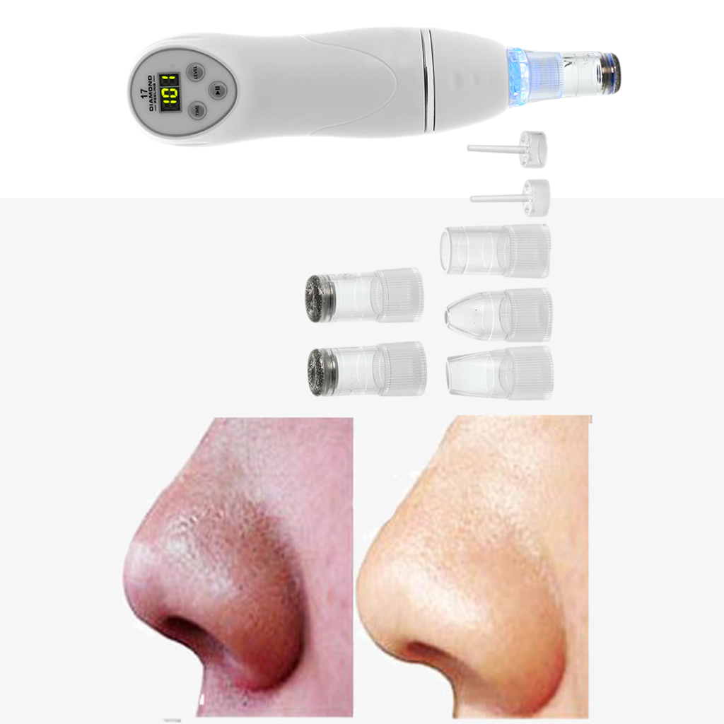 Black Head Remover with Hot Compress Vibration Function Face Pore Cleaner Plug-US