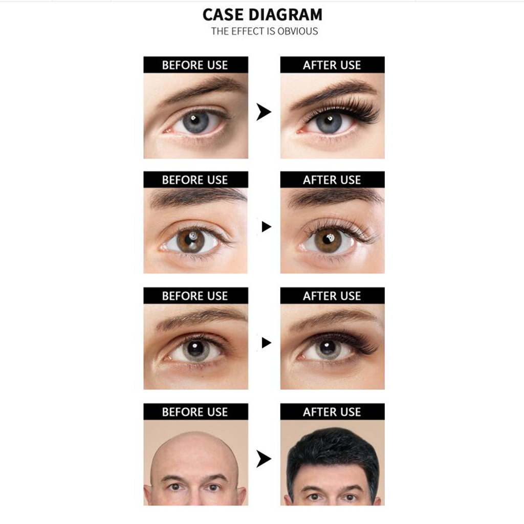 Natural Fast Hair Regrowth Essence Regrowth Anti Hair Loss Treatment Beard Dense Hair Products 30ml for All Hair Types