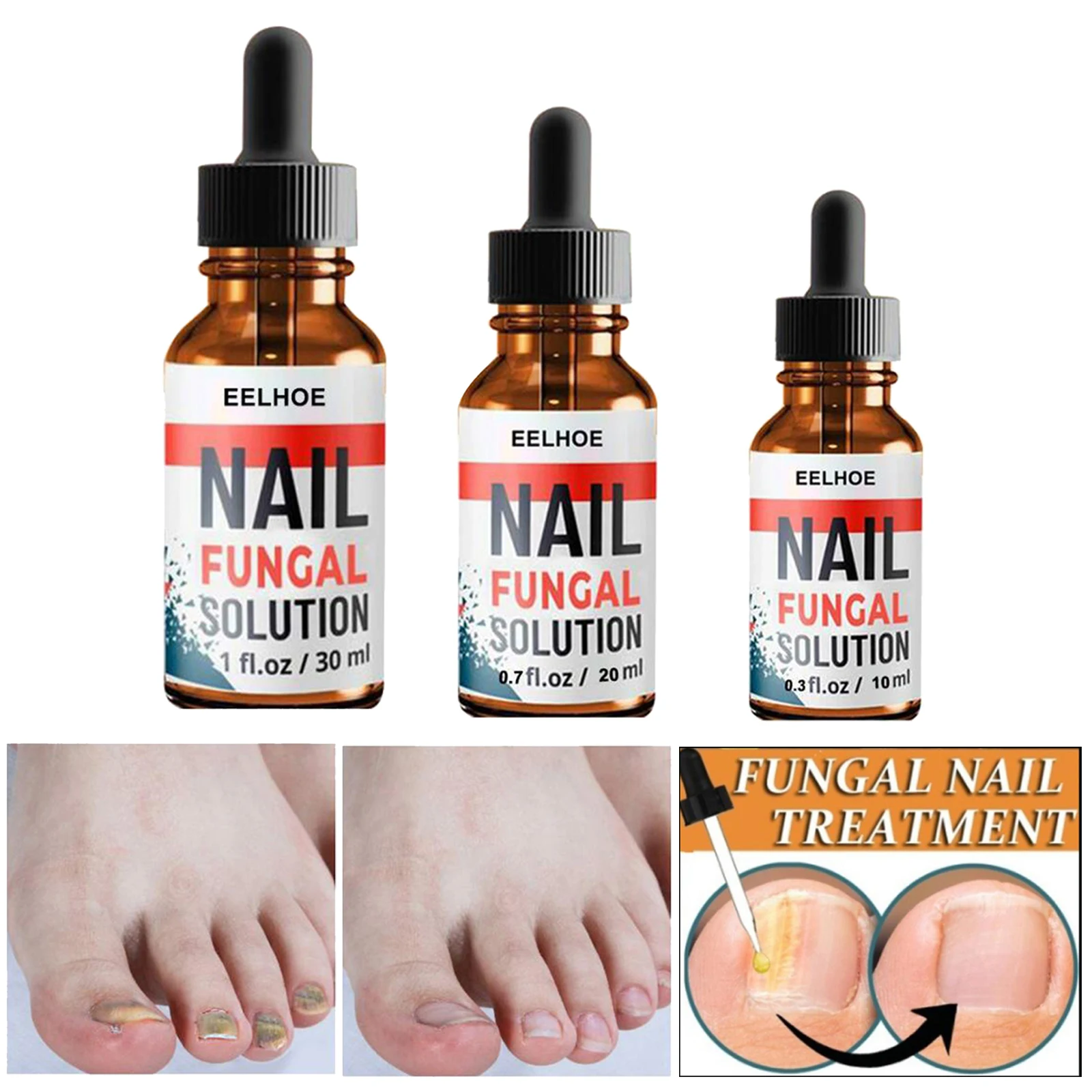 Fungal Nail Toenail Treatment Eczema Nail Relief Maximum Strength Clear Nails Repair Damaged Brittle Nail  Onychomycosis