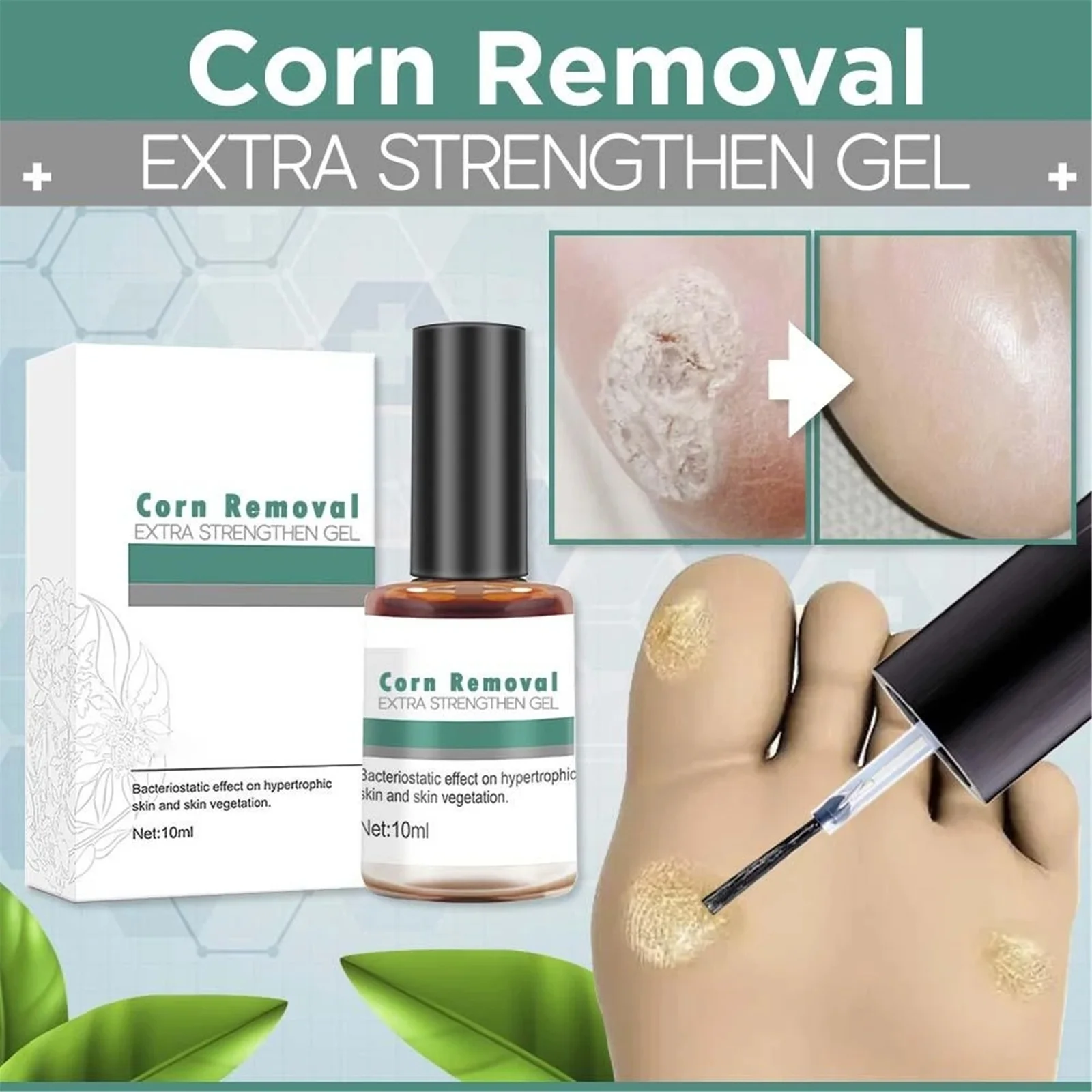 Hot Corn Removal Extra Strengthen Gel 10ml Body Warts Treatment Cream Foot  Care Cream Skin Tag Remover|Feet| - AliExpress