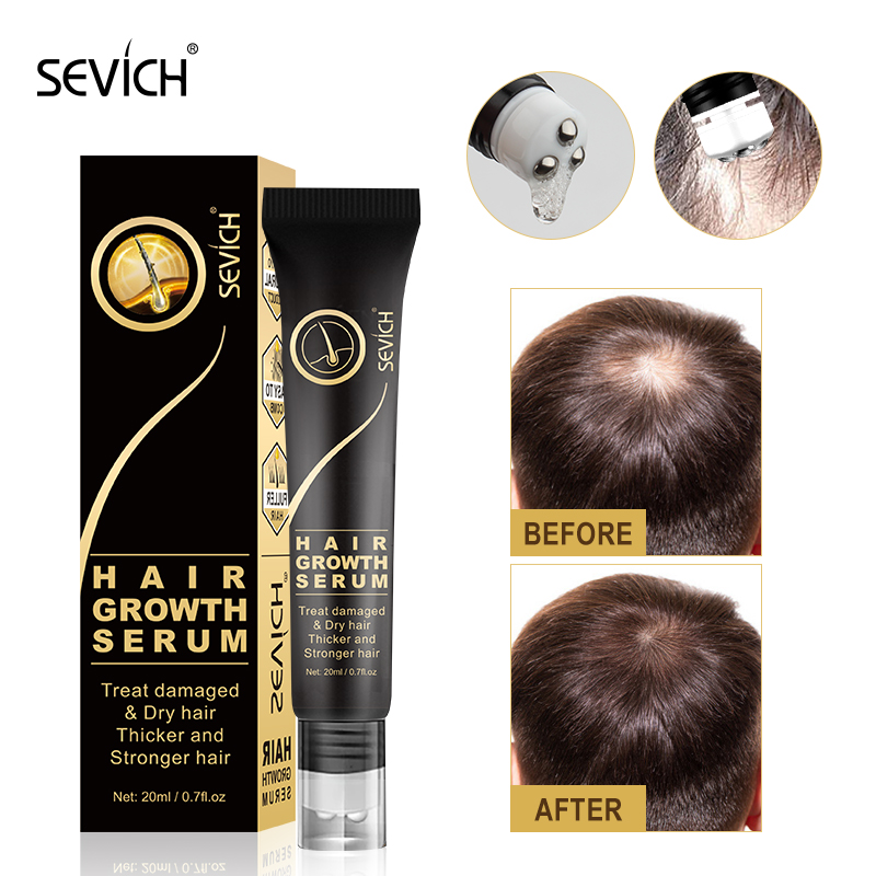 Best of Sevich Hair Growth Oil Ginger Extract Growing Serum Prevent Hair Loss Care Scalp Massage Roller Treatment Thickener Essence 20ml Reviews & Tips