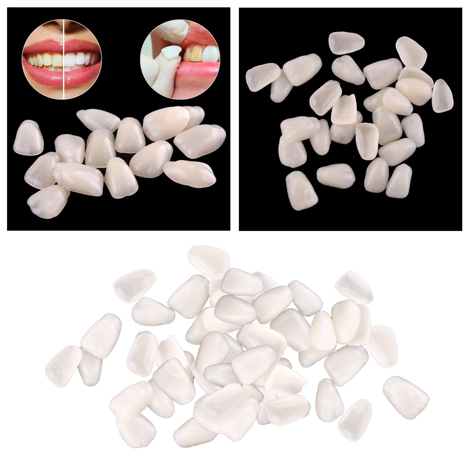 Ultra-Thin  Temporary Crown Ultra Thin Resin Whitening Teeth Upper Anterior Shade Tooth Veneers Oral Care Tool