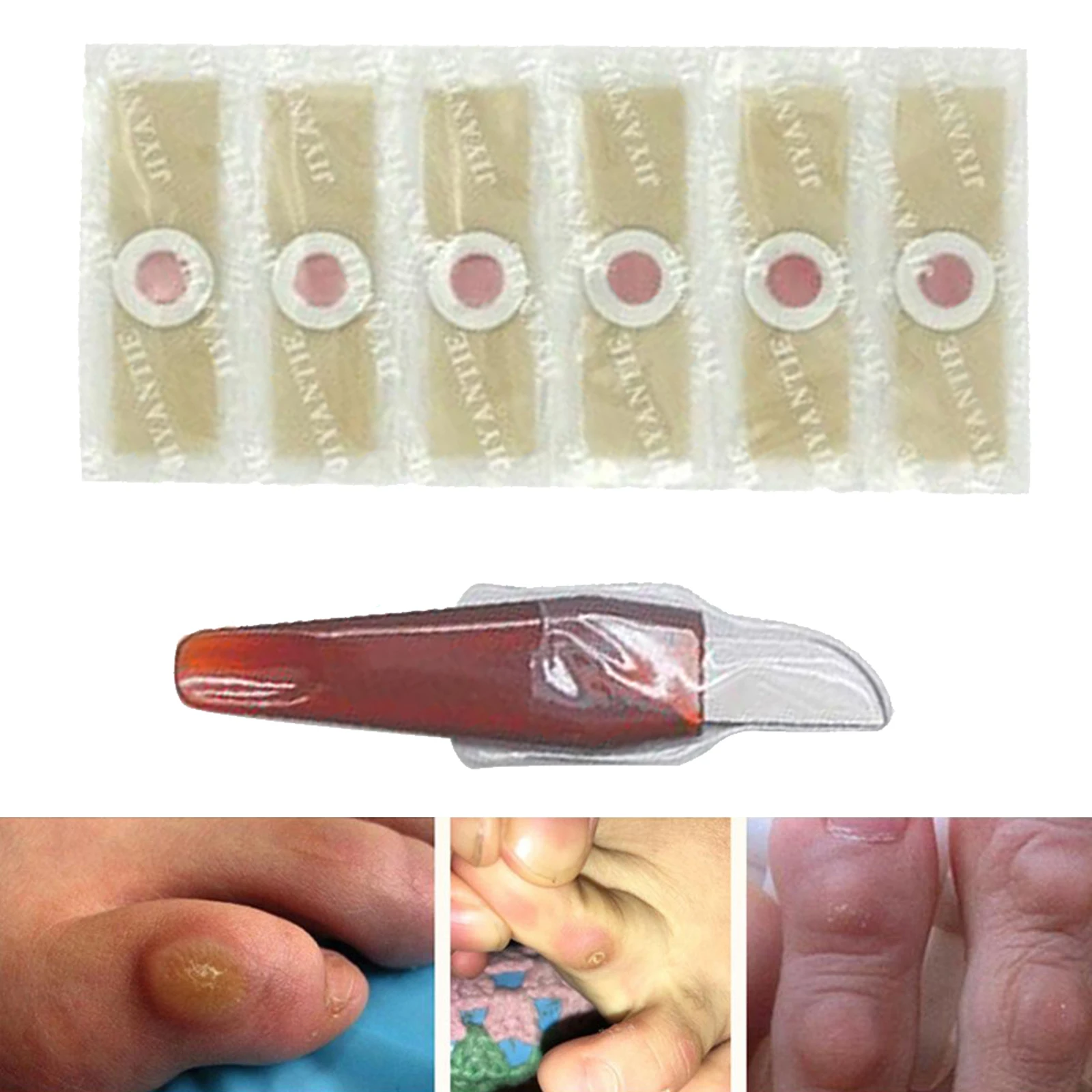 Pro Effective Foot Corn Removal Corn Remover Cushions Toe Protector with 