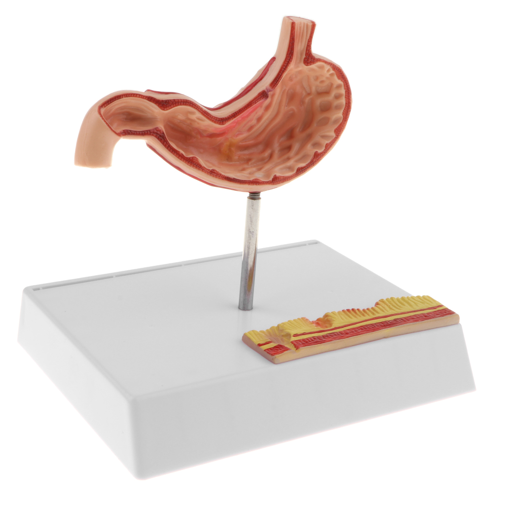 1: 1 Human Stomach Model with Detailed Illustrations, Anatomy