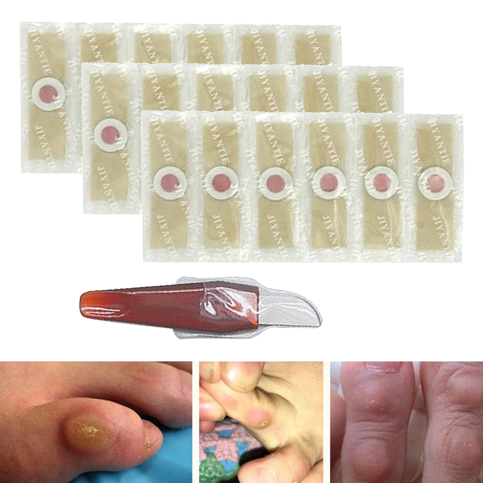 Pro Effective Foot Corn Removal Corn Remover Cushions Toe Protector with 