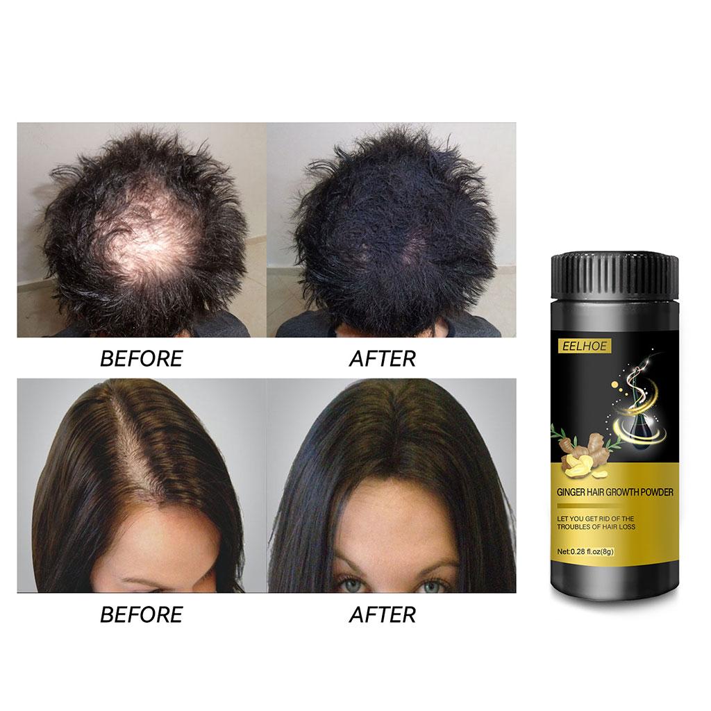 Ginger Hair Growth Powder Scalp Oil Control Promotes Thicker Hair Care Essence for Hair Care Prevent Thinning Prevent Dry Adults