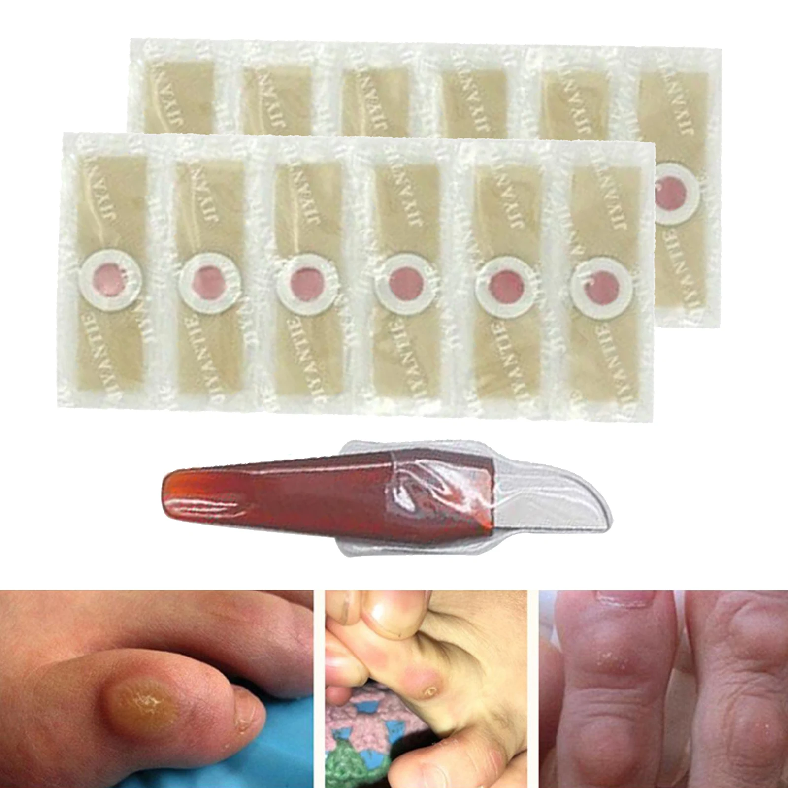 Pro Effective Foot Corn Removal Corn Remover Cushions Toe Protector with 