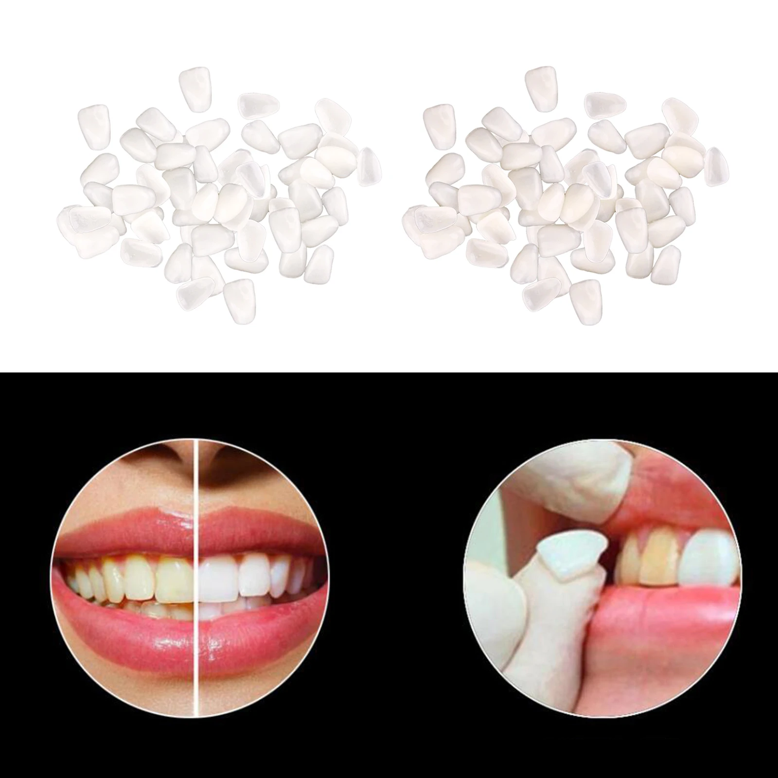 Teeth Tooth Temporary Crown Veneers Anterior Mixed Type Dentist Products