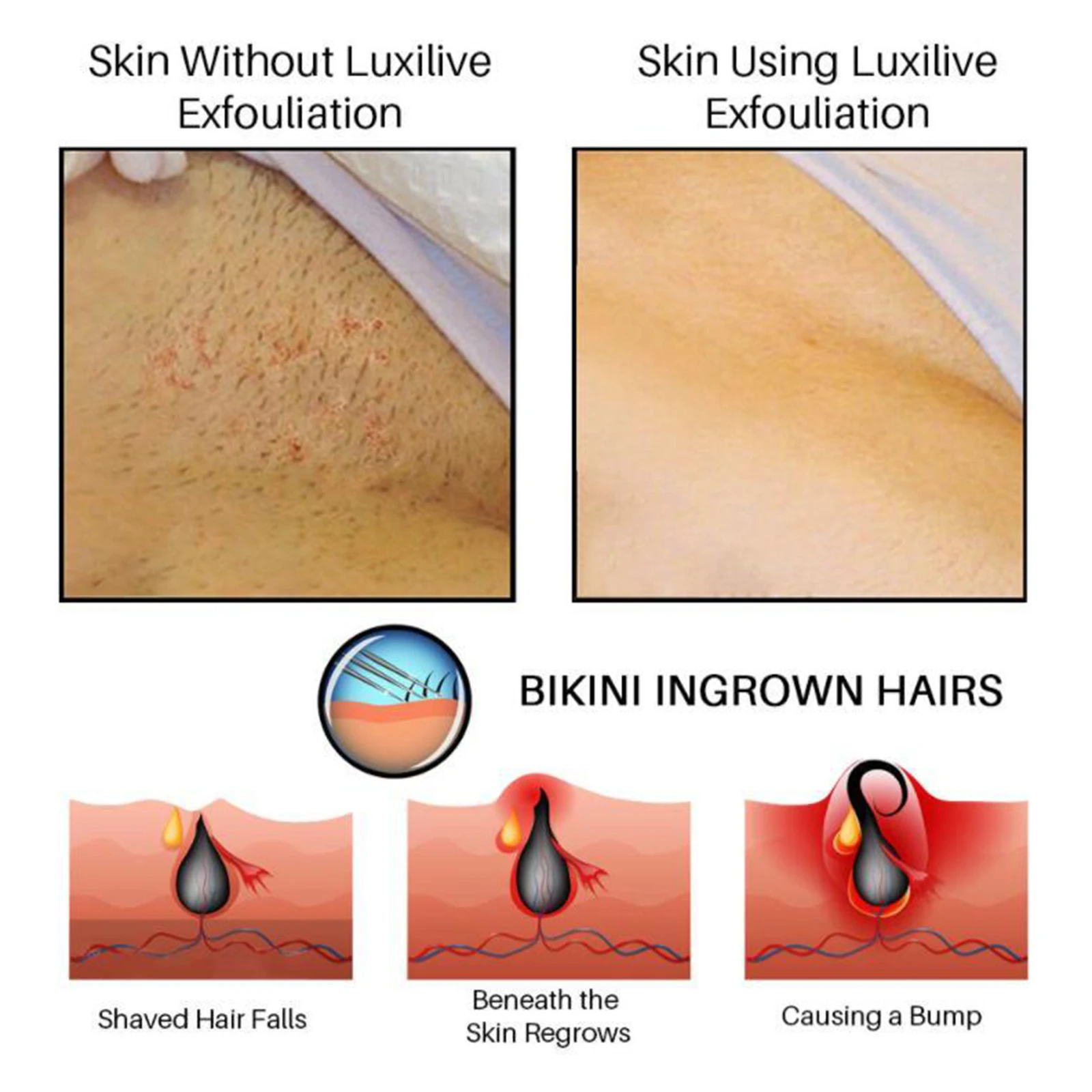 100ml Bumps Solution Aftershave Serum for Razor Bumps After Hair Removal