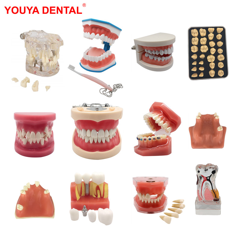 Best of 2022 Various Dental Model Teeth Teaching Model Study Removable Orthodontic Implant Tooth Models Resin Dentistry Dentist Material Reviews & Tips