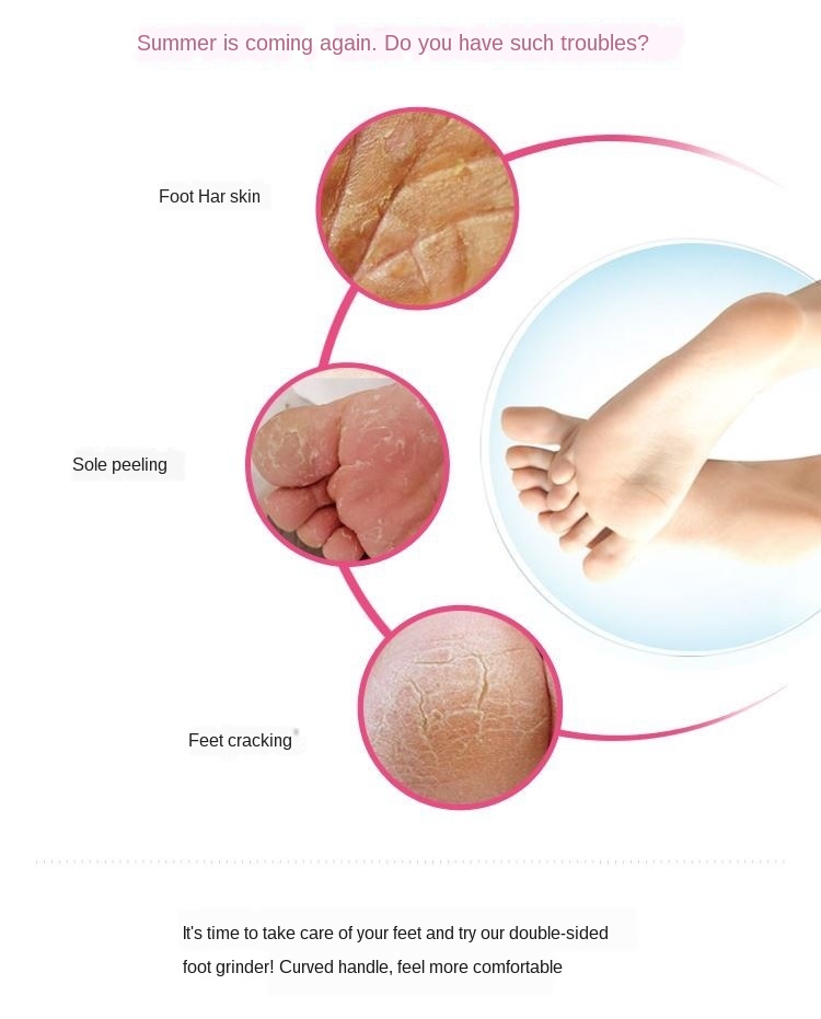 11329230306_356674875