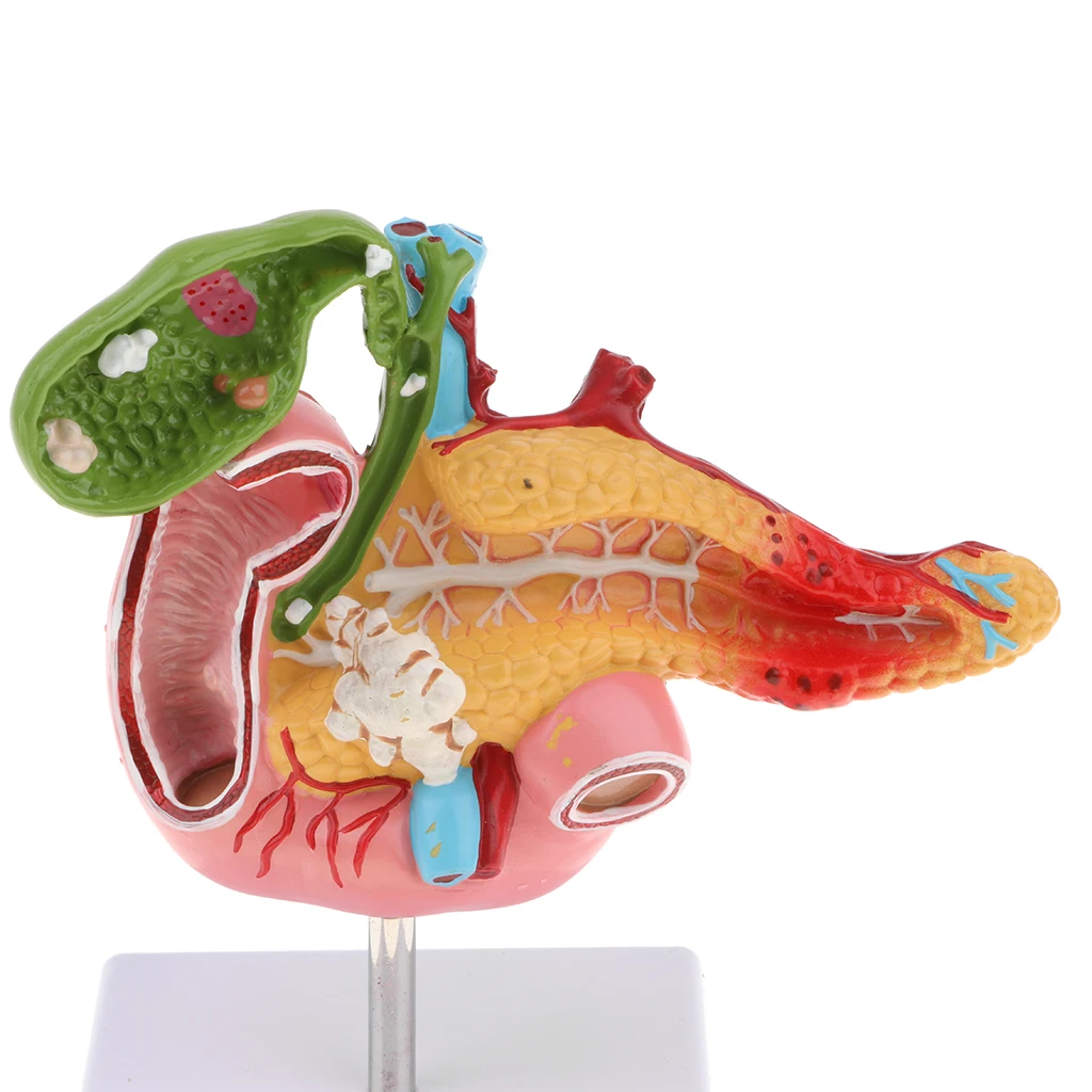 Lifesize Human Pancreas Duodenum Gallbladder Pathological Model with Blood