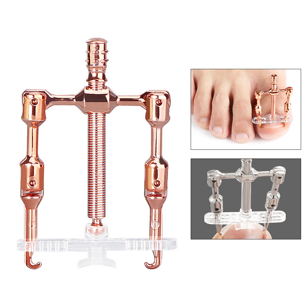 Stainless Steel Mini Toe Nail Corrector Correction for Foot Ingrown Toenail
