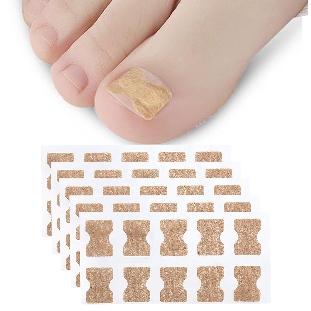 Pack 50 Ingrown Toenail Corrector  Treatment Tape Foot Nail Care