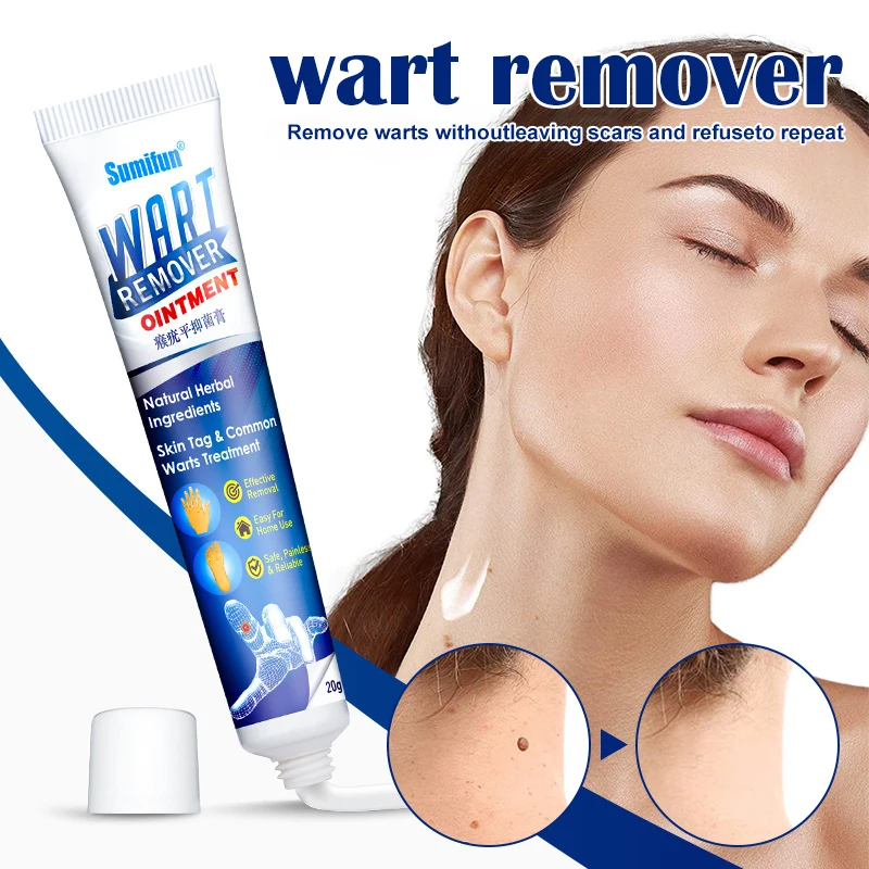 Warts Remover Antibacterial Ointment Wart Treatment Cream Skin Tag
