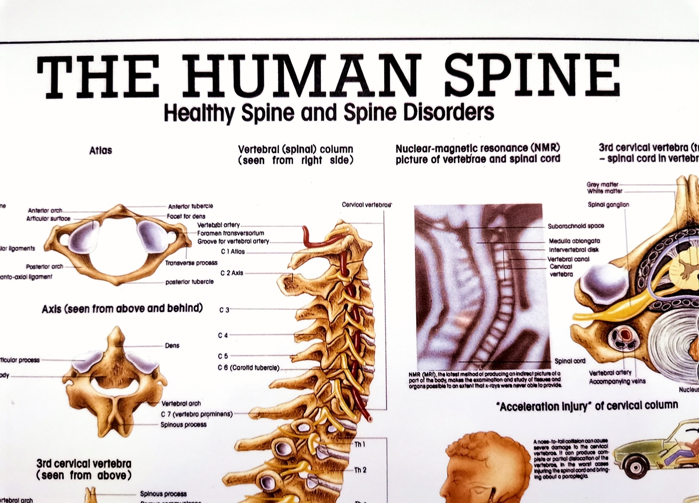 Плакат с человеческим позвоночником, анатомия скелета человека, атлас, настенные