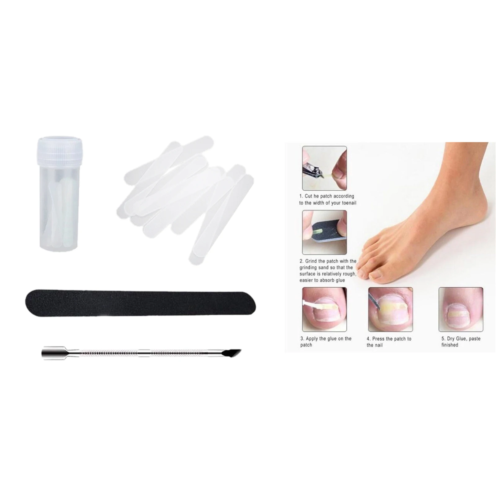 Professional Pedicure Ingrown Toe Nail Straightening Clip Brace Foot Care Toe