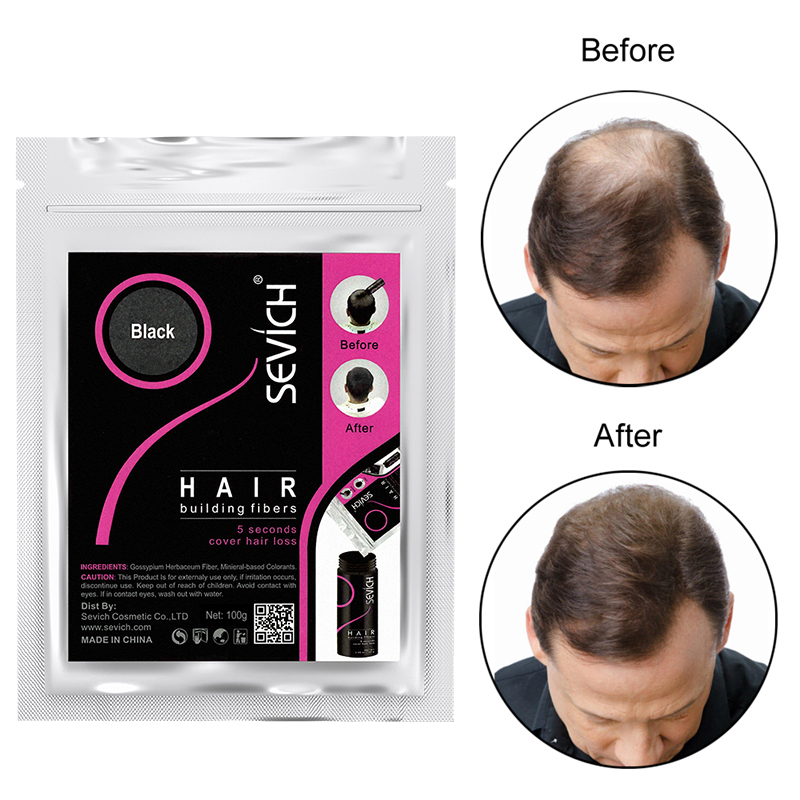 Best of Sevich 100g Hair Fibers Refill Bag Bald Extension Hair Growth Powder Salon Professional Hair Treatment Unisex Hair Loss Products Reviews & Tips - Image 2