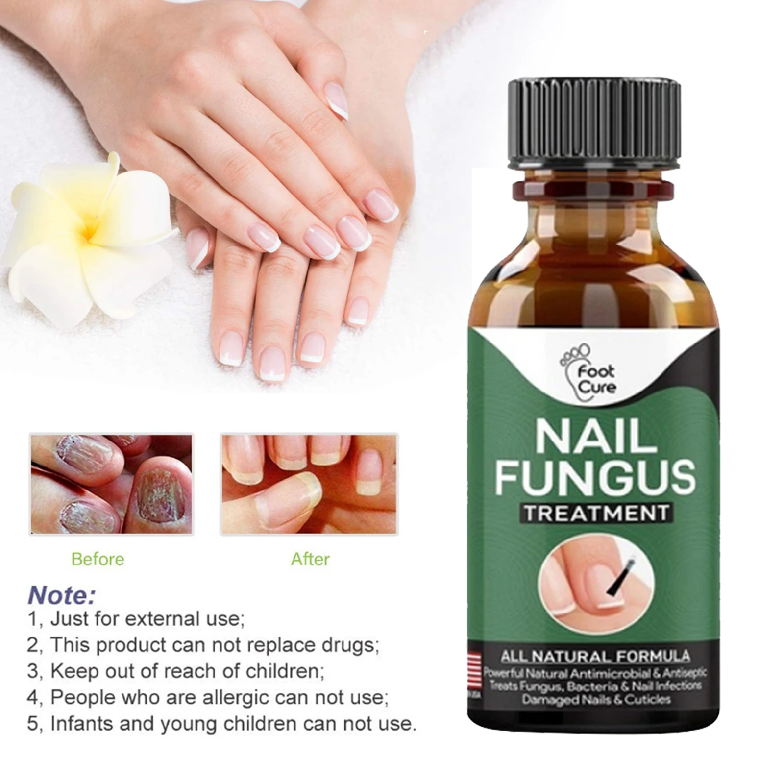 Toe Fungal Nail Essences Treatment Antifungal Repair Gel Nail Pedicure Tool