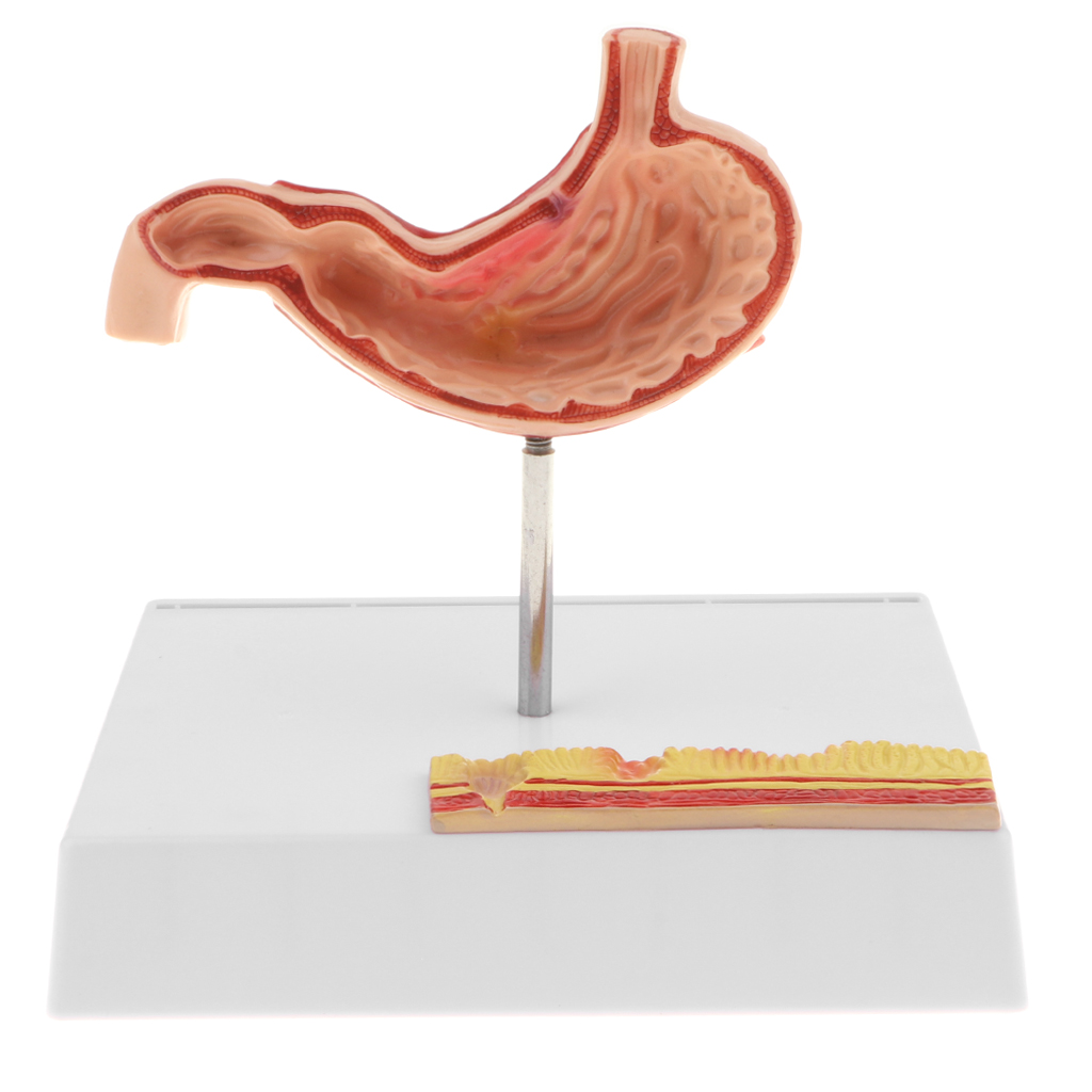 1: 1 Human Stomach Model with Detailed Illustrations, Anatomy