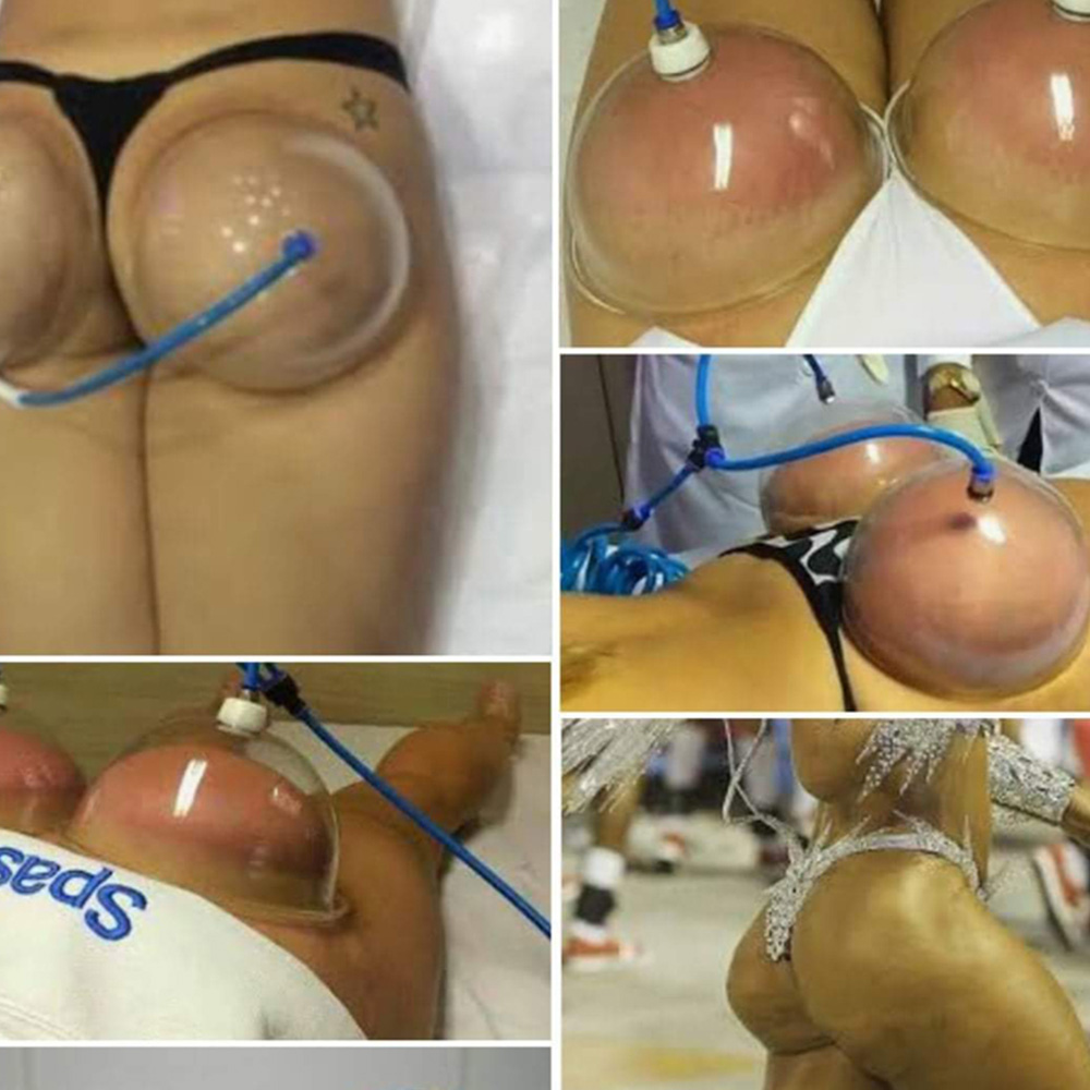 Best of Breast Buttocks Enhancement Pump Lifting Vacuum Cupping Suction Therapy Device Enhance Reviews & Tips