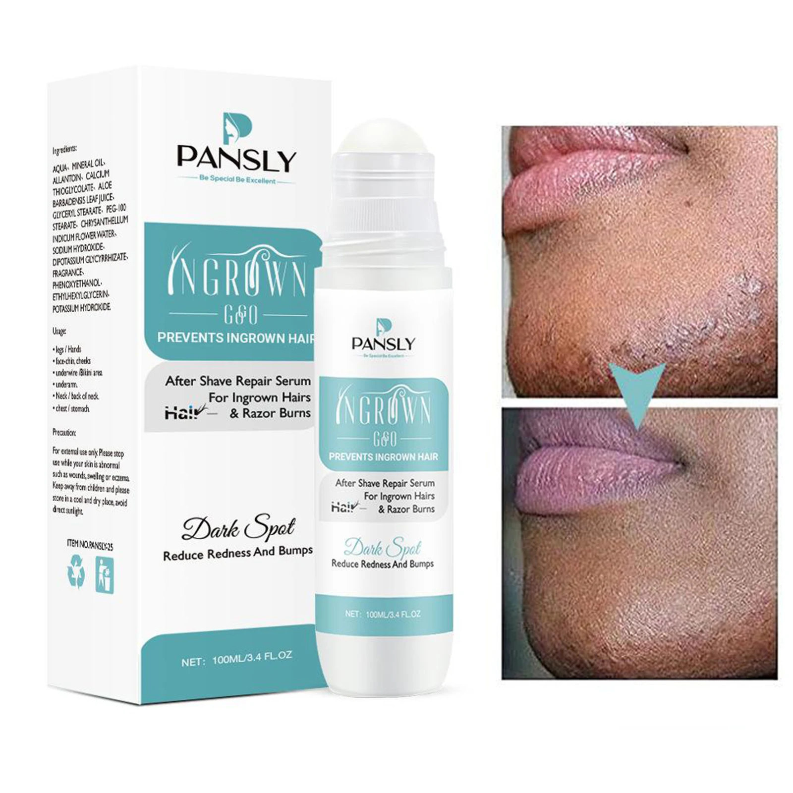 100ml Bumps Solution Aftershave Serum for Razor Bumps After Hair Removal