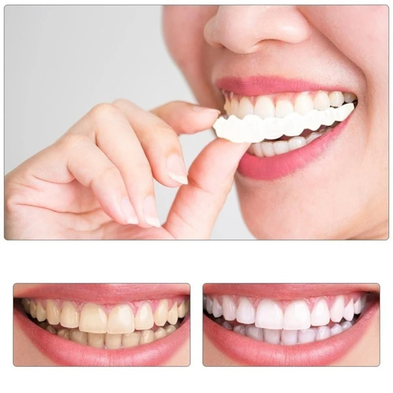 Instant Smi-le  Cosmetic Teeth, Natural Bright White Shade, Comfortable Upper and Lower Veneer