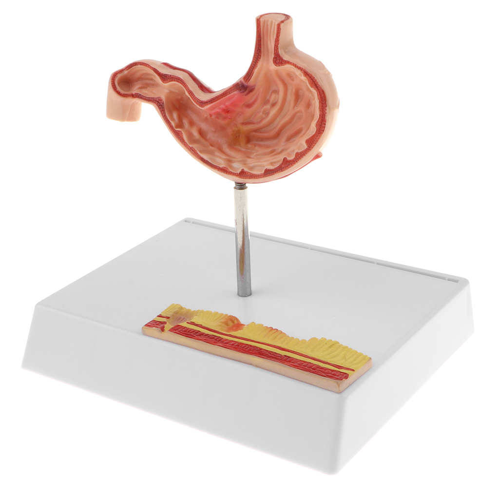 1: 1 Human Stomach Model with Detailed Illustrations, Anatomy