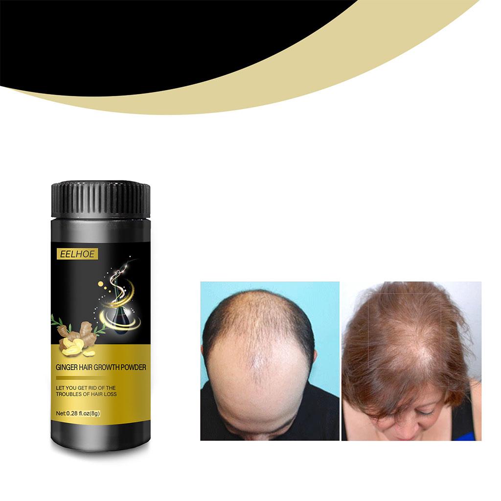 Ginger Hair Growth Powder Scalp Oil Control Promotes Thicker Hair Care Essence for Hair Care Prevent Thinning Prevent Dry Adults