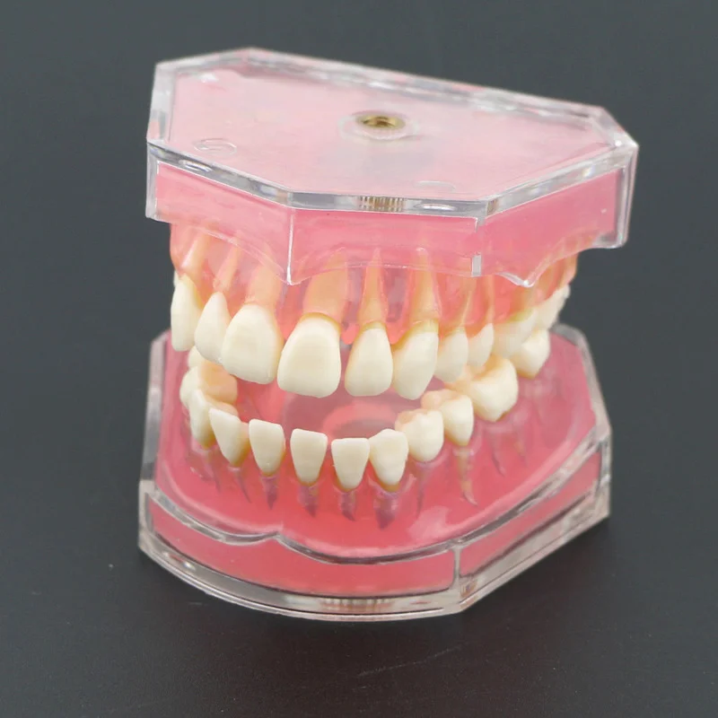 dentes removíveis, goma macia, adulto TYPODONT