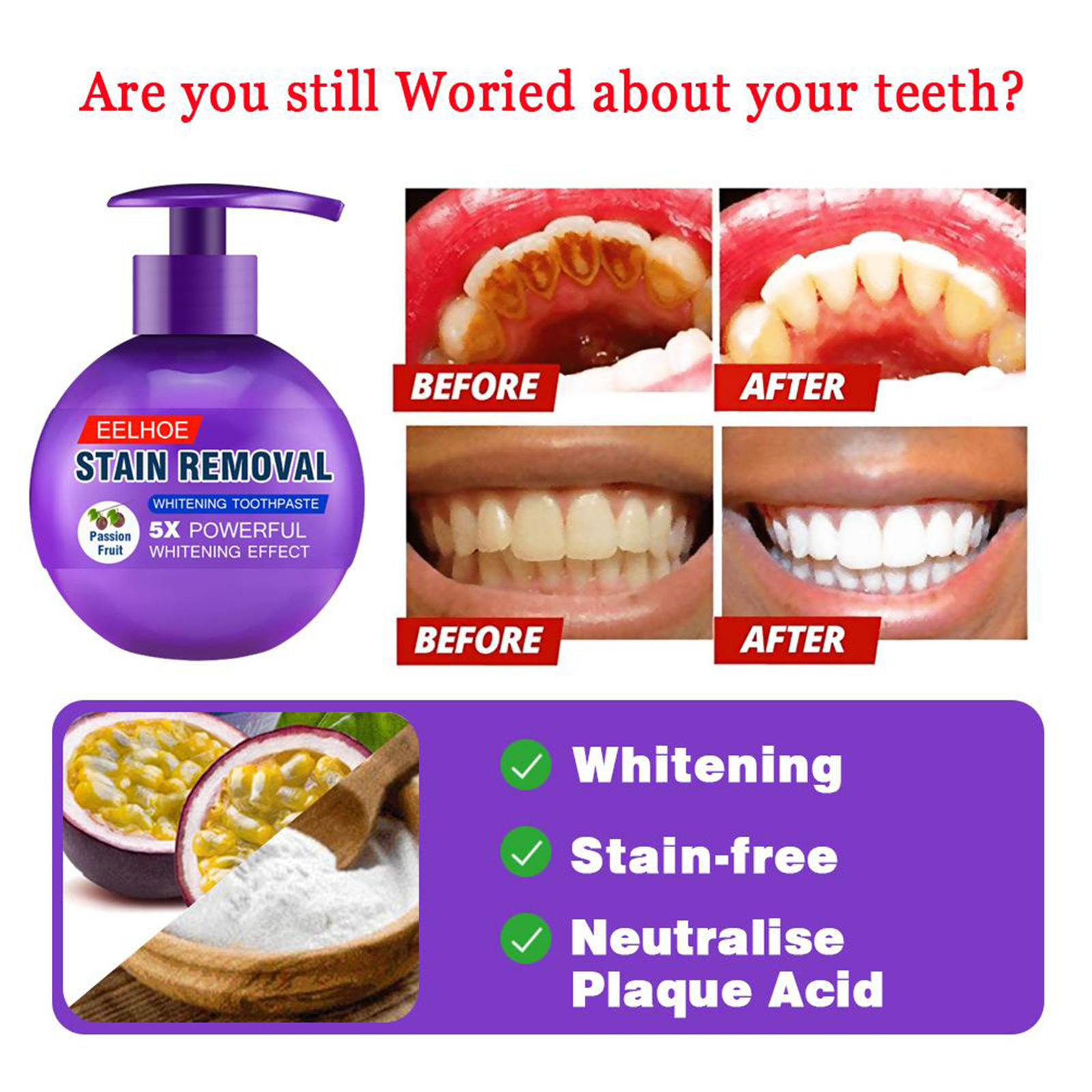 baking soda for teeth stains