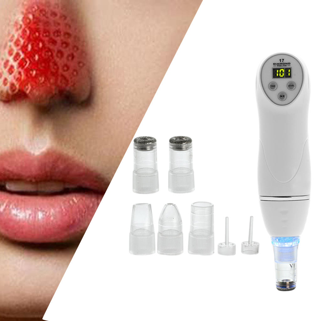 Black Head Remover with Hot Compress Vibration Function Face Pore Cleaner Plug-US