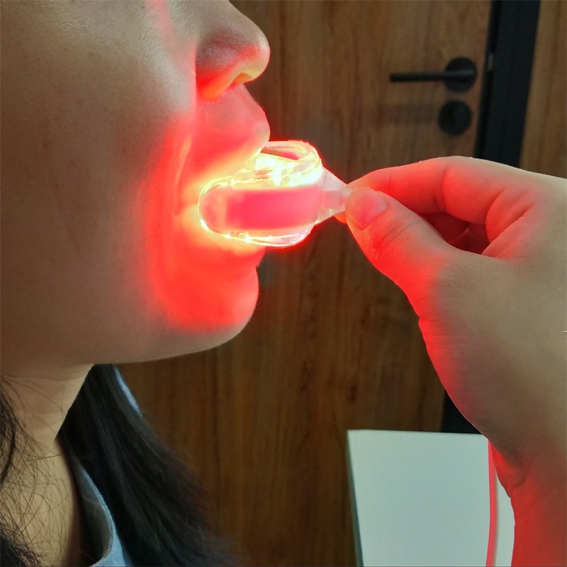 Best of Tooth Sores Cure Reliever Gingivitis Therapy LED Red Light Therapentic Device Reviews & Tips